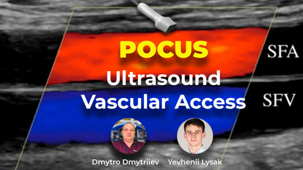 Онлайн школа POCUS: Vascular Access