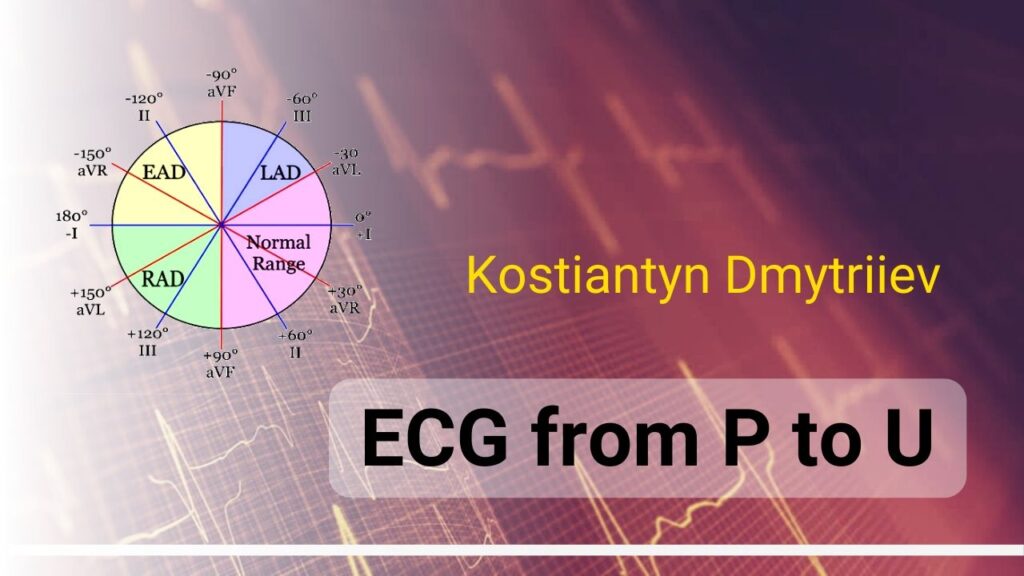 Онлайн школа ECG from P to U